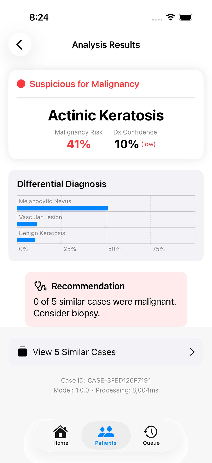 Skinpendium analysis result showing a calibrated malignancy risk and a differential diagnosis